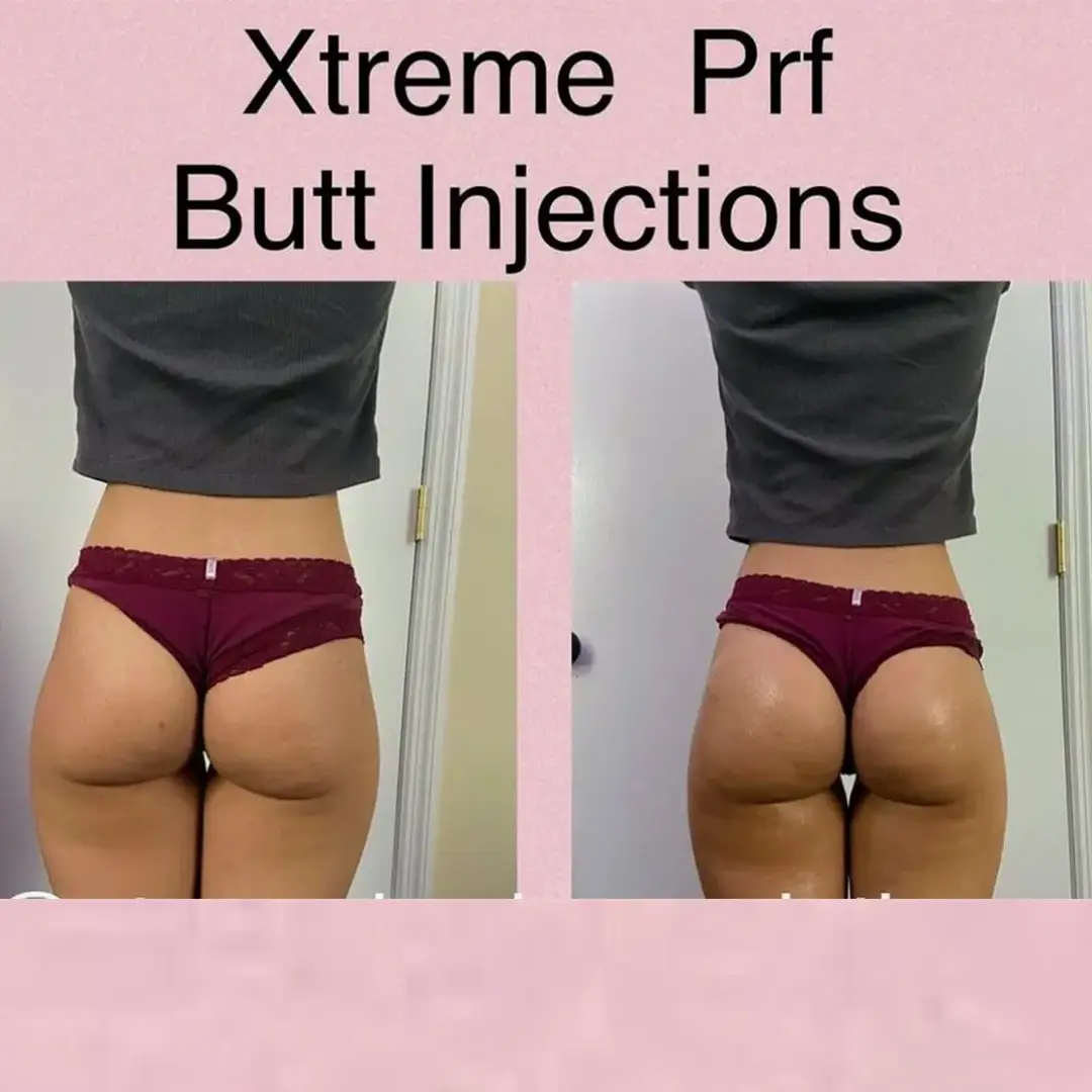 before-after-pic-1_batcheditor_fotor